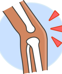 ARTHRITIS