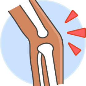 ARTHRITIS